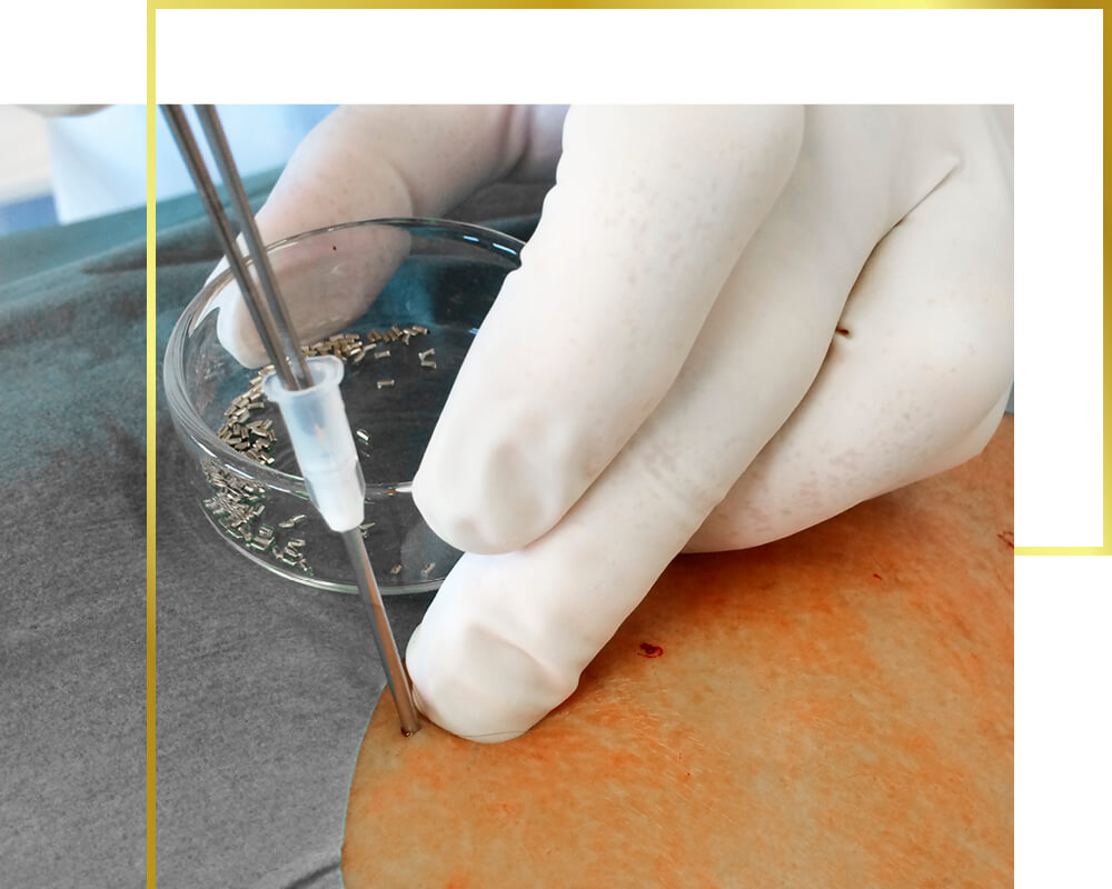 Gold implantation aftercare, gold therapy